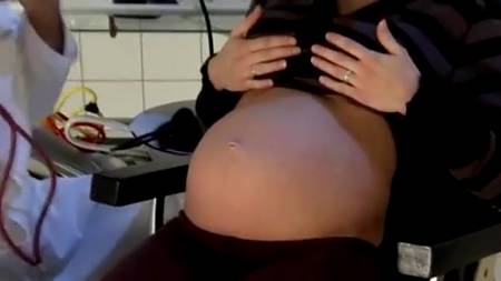 Беременная на приеме у стоматолога