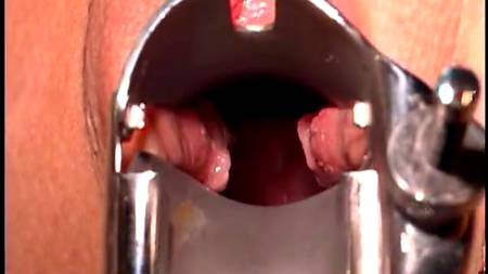 Потрясающий осмотр у гинеколога