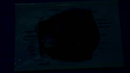 Пациентка слишком возбудилась перед приемом